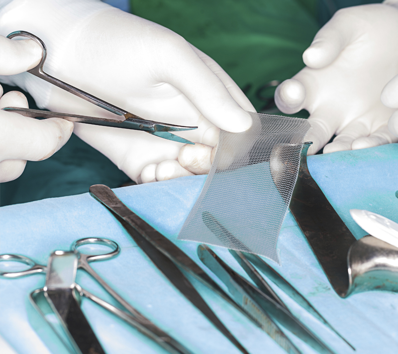 Hernia Surgery